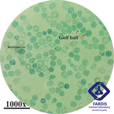 Golf ball